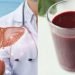 5-sveikiausi-gerimai,-skirti-naturaliai-isvalyti-kepenis:-jie-lengvai-paskatina-valymo-procesa