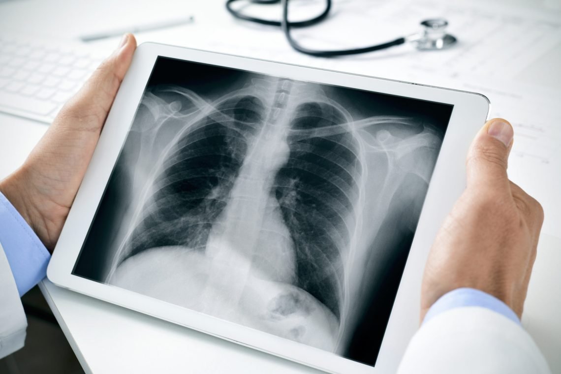 Radiologija