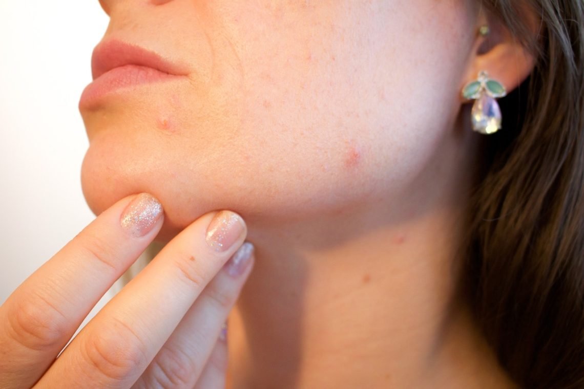Dermatologo konsultacija